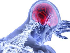 ataxia que es