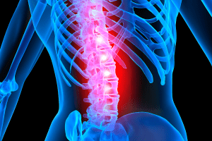 tipos de lesiones medulares