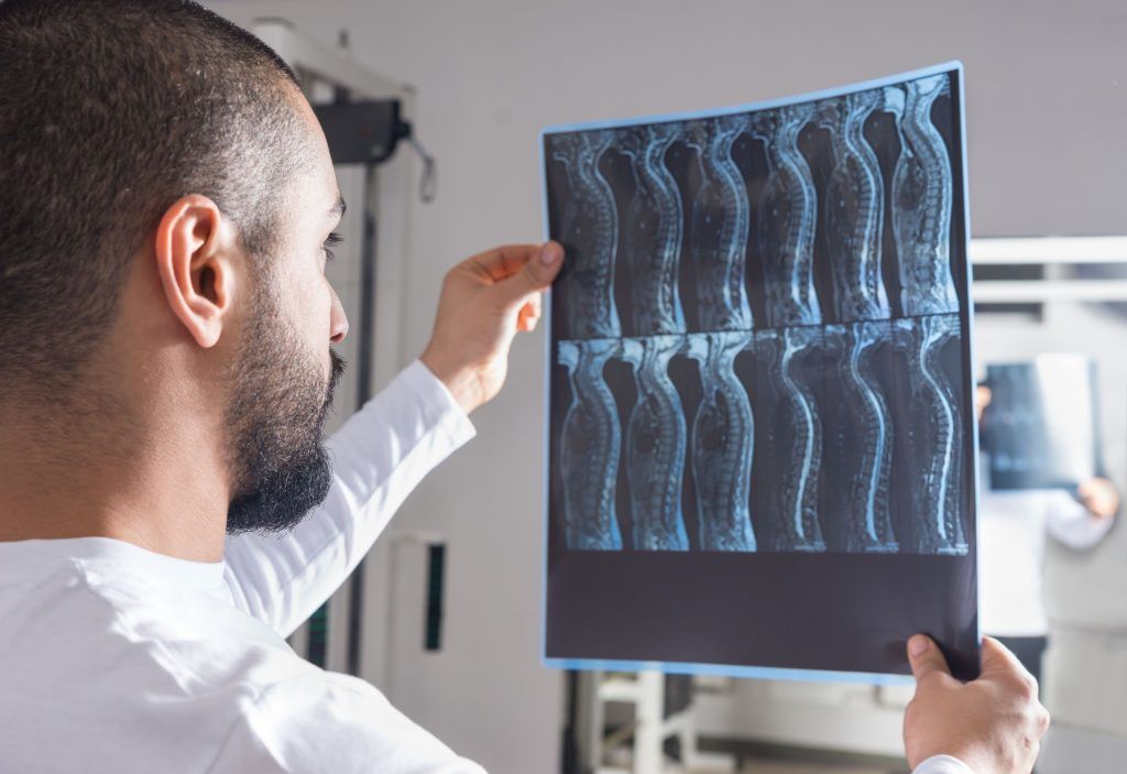tipos de lesión medular radiografía