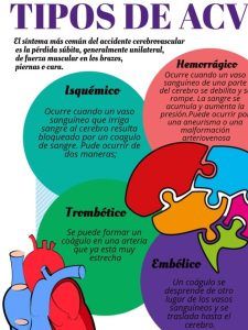 tipos de ictus