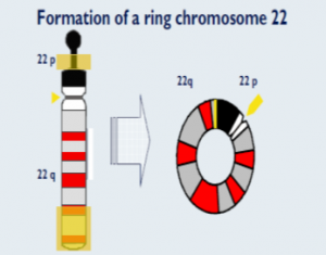 , Síndromes en el cromosoma 22q